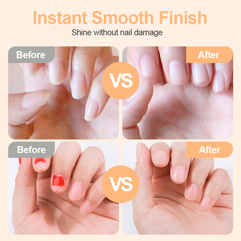 🥳2026 HOT SALE🥳💞50K+ SOLD!⚡💅 50% OFF! 2-in-1 Smart Electric Nail Clipper & Polisher